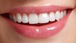 © Bart - a close-up of a radiant smile with perfectly white teeth and natural pink lips.