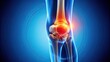 © Sayfar - Detailed close-up of knee joint with osteoarthritis condition
