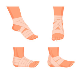 Wall Mural - injured human feet. bandaged ankles, damaged legs parts, emergency treatment for sprains and bones f