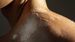 © Darunee - A large, healed scar on a person's shoulder, with visible texture and soft lighting emphasizing the skinâ€™s contours