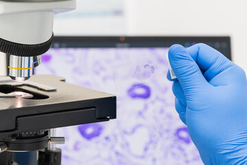 scientist wear blue glove holding parafin human tissue block and out of focus microscope and compute