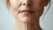 © Alpha - Visual transformation of a woman's mouth area, highlighting before with wrinkles and after a wrinkle-reducing treatment with visibly smoother skin