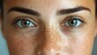 © Alpha - Transformation of skin with rough texture and dark pigmentation before combined Botox and melasma treatment, highlighting smooth, radiant skin after