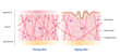© Mosterpiece - Comparison of young and aging skin vector on white background. Cross section of high and low density of collagen, elastin fibers and fibroblasts in the dermis layer. Skin care and beauty concept.