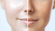 © Alpha - Detailed comparison of skin texture and pigmentation, illustrating Botox's wrinkle reduction and melasma spot fading, clear skin tone in after shot, Soft Lighting, Photorealistic