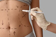© Pixel-Shot - Plastic surgeon marking woman's belly on light background, closeup