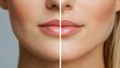 © Alpha - Write an article on the long-term effects of facelifts, using before-and-after images to show improvements in fine lines and deep wrinkles