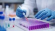 © TI3ee - A scientist in blue gloves uses a pipette to transfer liquid from a test tube to a microplate.