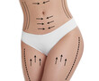 © New Africa - Woman with perfect slim body on white background, closeup. Figure correction arrows and lines on skin
