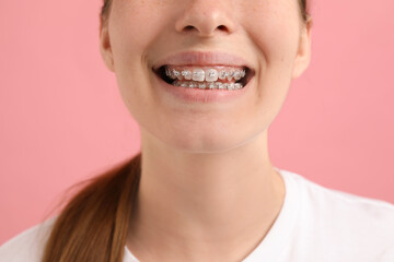 Girl with braces on pink background, closeup