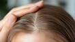 © Анна Озарчук - Hand gently touching a scalp with visible patches of hair loss.