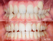 © Ivan - Before and after images showing orthodontic treatment results