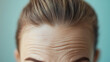 © Premium_art - Close-up of a woman's forehead showing wrinkles.