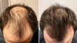 © MSH - A before and after photo of a hair loss treatment, Before and after people head