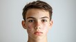 © WINGGOD - Teenage boy with active acne on his forehead and cheeks, looking directly at the camera with a neutral expression