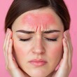© Big9869 - Close-up portrait of a woman with red, irritated skin on her forehead. She is holding her head in her hands.