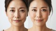 © Chirawan - Photos of Asian, Korean, and Japanese women's faces showing their problematic and clean faces without blemishes, before and after photos for advertisements for skin care products and cosmetics.