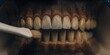 © DVS - Close-Up of Brushing Decayed Teeth in Dental Model