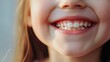 © Veronika - a child smiling wide close up of a mouth dental care concept with a text space