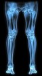© imagineRbc - A blue skeleton leg is shown in a black background. The leg is shown in a very detailed and realistic way, with the bones clearly visible. Concept of awe and wonder at the complexity of the human body