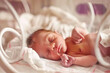 © EvgeniiaFreeman - Premature infant resting in hospital incubator for neonatal care. World prematurity day, 17 november. Prematurity awareness month