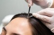 ©  S u n n y B u n n y - Professional hair transplant procedure focused on scalp treatment for natural hair restoration
