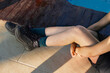 © Laura Herrera/Stocksy - Young woman's legs showing psoriasis skin condition
