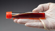 © Thanakrit - A hand in a glove holds a test tube filled with dark red liquid, likely blood, highlighting clinical or medical contexts.