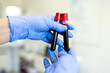 © Hanna Bondarenko - Hands of a doctor or nurse in blue medical gloves hold test tubes with blood. Blood sampling in the hospital. Blurred background, details.