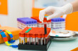 © Vadim - Lab tech processing blood samples. A technician in a lab is carefully handling a blood sample tube while preparing tests and samples nearby.