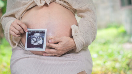 A pregnant woman support her abdomen with her hands and holds an ultrasound image of her fetus together. On the background of the lawn behind the house