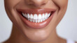 © lukshan - Close-Up of a Woman's Smile with Perfectly White Teeth