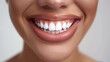 © lukshan - Close-Up of a Woman's Smile with Perfectly White Teeth