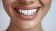 © lukshan - Close-Up of a Woman's Smile with Perfectly White Teeth