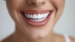 © lukshan - Close-Up of a Woman's Smile with Perfectly White Teeth