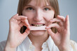 © Михаил Решетников - Young woman with metal braces on her teeth is chewing gum. The girl is eating gummy candy