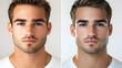 © gnoparus - Before & After Man's Skincare Transformation - Split Screen Portrait