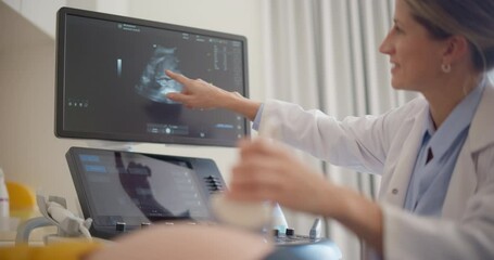 Aufkleber - Close Up on Doctor's Hand Using Advanced Ultrasound Equipment to Examine a Pregnant Woman, Explaining Details About the Fetus. Excited Female Patient Smiling as She Sees the Baby’s Image on Display
