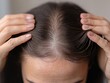 © dominic - Female Hair Parting Thinning Hair Loss Scalp Crown View