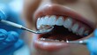 © visoot - Close-up of a smiling child receiving orthodontic treatment, with dental tools being used by a dentist wearing blue gloves.