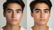 © Herseliia - Caucasian Man, Treatment Dermatology, Cosmetology Procedures, Freckles, Acne, Before and After Banner