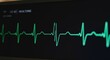 © SERHII - Heartbeat monitoring display featuring vital signs and health tracking