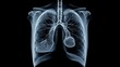 © Horizen - Detailed digital x-ray image of human lungs and heart anatomy on black background