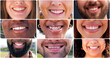 © peopleimages.com - Dental, diversity and smile with collage of people in city for happy, pride and teeth cleaning. Mouth, wellness and oral hygiene with closeup of lips with facial expression for confidence and braces