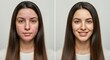 © gn8 - Skincare transformation: before and after of young caucasian woman with clear and acne-affected skin