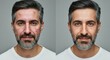 © gn8 - Before and after skincare transformation of mature caucasian male highlighting clean skin