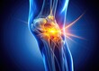 © nick - Night's glow illuminates an inflamed knee joint, showcasing nerve anatomy in detailed medical illustration.