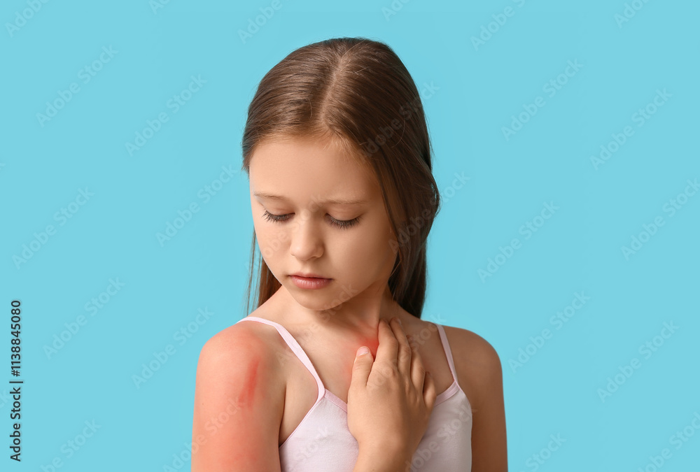 Cute little girl looking at red sunburned shoulder on blue background