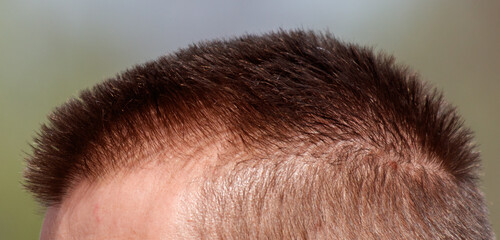 A man with a shaved head