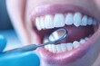 © Siripong - Dental check-up action dentist office health service clinical environment close-up view oral care concept